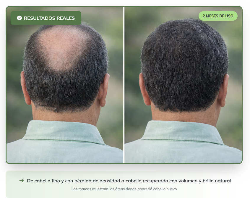 Antes y Después - Casos Reales