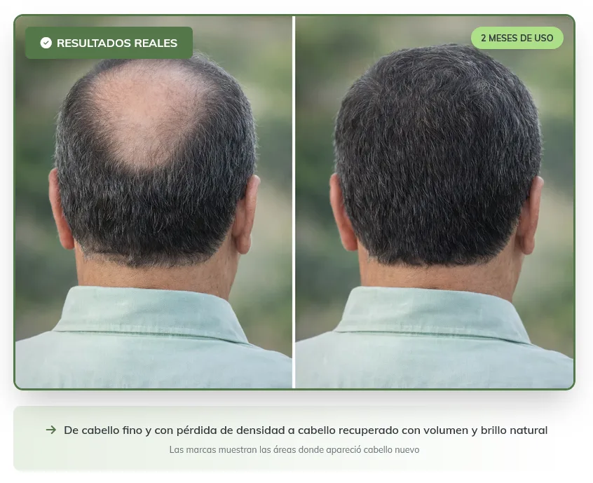 Antes y Después - Casos Reales